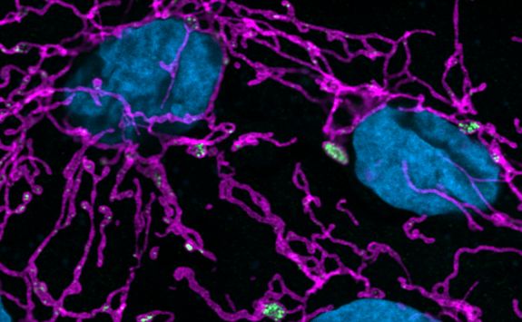 Hyperfused mitochondria and DNA